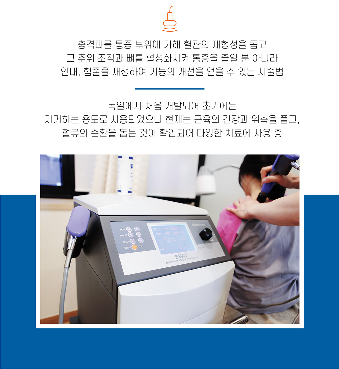 체외충격파 설명