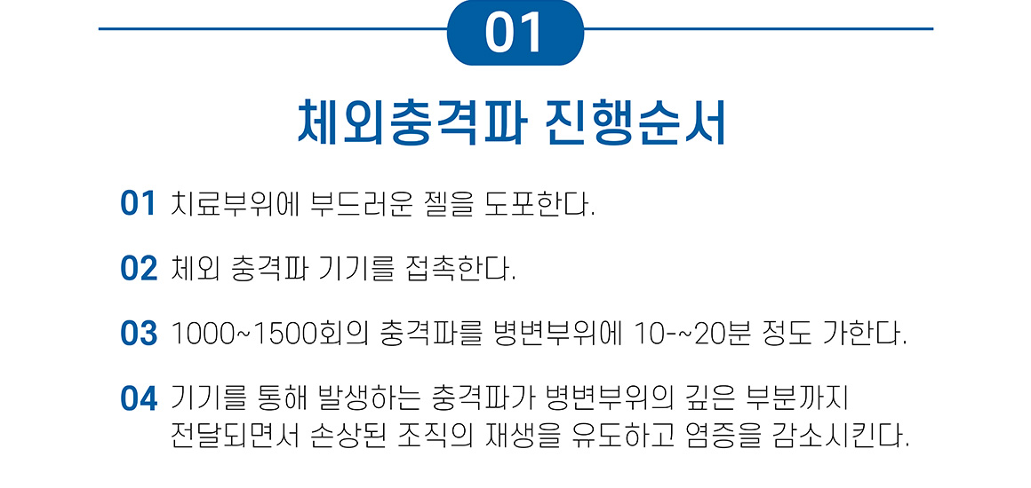 체외충격파 진행 순서